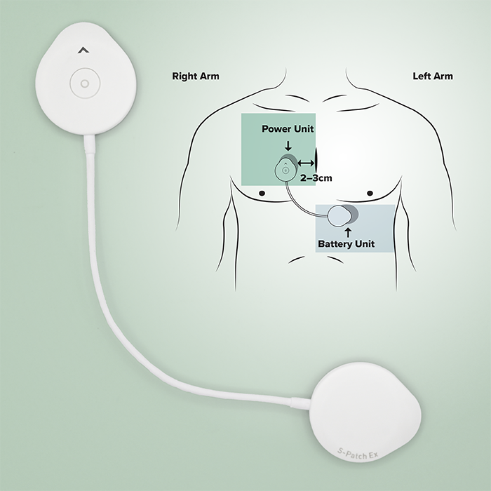 S-PATCH-EX With Diagram 