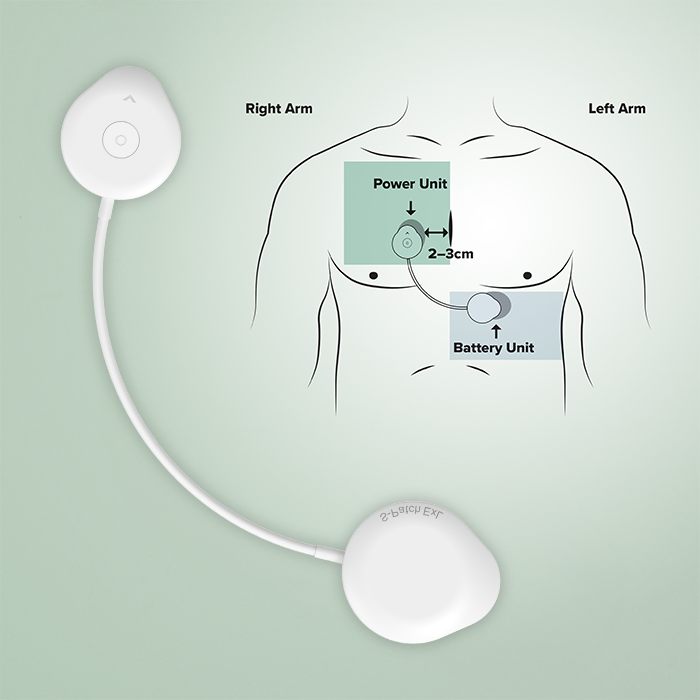 S-Patch ExL with illustrated diagram of device power unit and battery unit