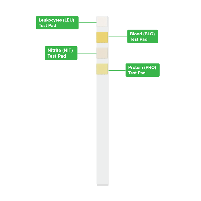Urinary Tract Infection Screening Strip infographic