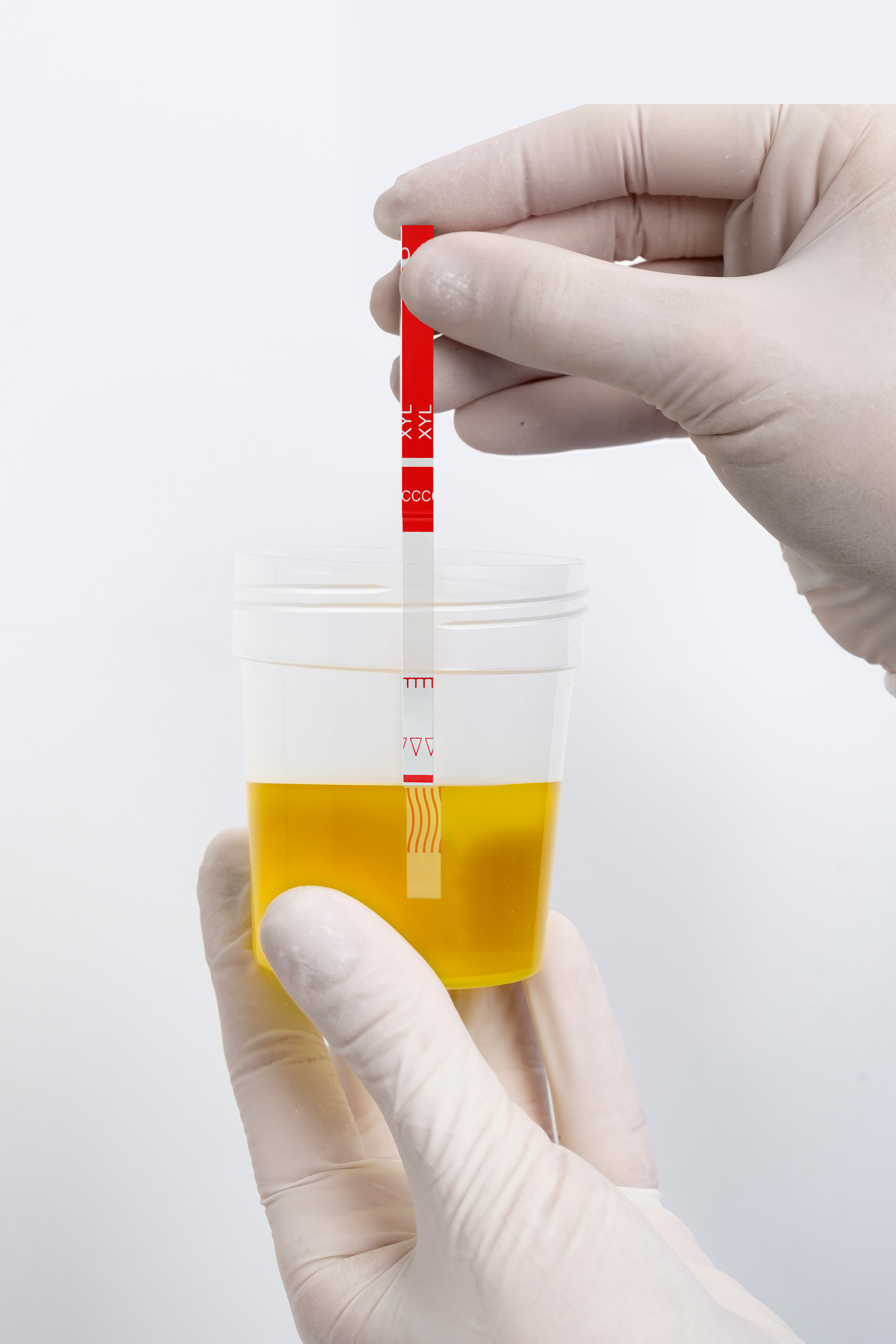 Xylazine Test Strip (Urine) Lifestyle Image